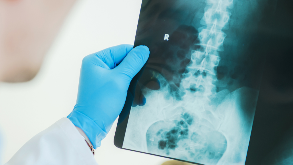 X ray Ingleburn