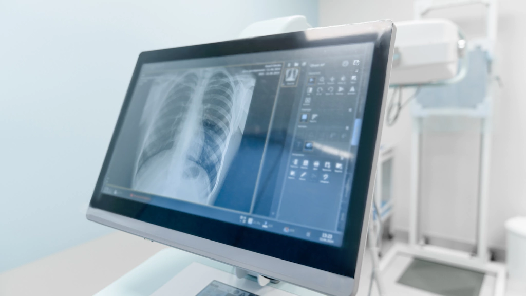 CT Calcium Scoring Information Guide